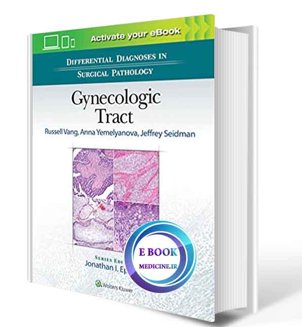 دانلود کتاب  Differential Diagnoses in Surgical Pathology: Gynecologic Tract 2018 ( PDF)